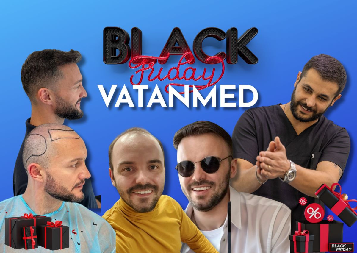 Petak je dan za novi početak: Transplantacija kose u Vatanmedu po posebnim Black Friday cijenama Petak je dan za novi početak: Transplantacija kose u Vatanmedu po posebnim Black Friday cijenama