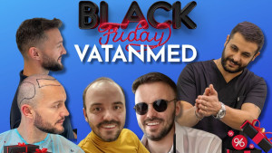 Petak je dan za novi početak: Transplantacija kose u Vatanmedu po posebnim Black Friday cijenama