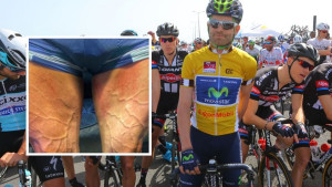 Biciklizam nije za svakoga: Španac pokazao kako izgledaju noge nakon četiri sata utrke