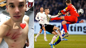 Gaćinović se oglasio nakon krvničkog starta 