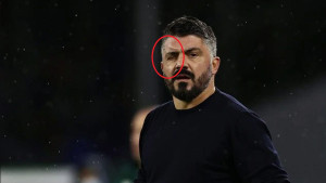 Gattuso ima neobičan problem, nije uspio doći na pressicu