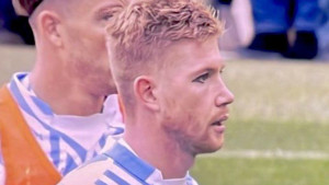 Englezi mislili da je De Bruyne našminkanog oka odigrao meč, a onda je stiglo objašnjenje
