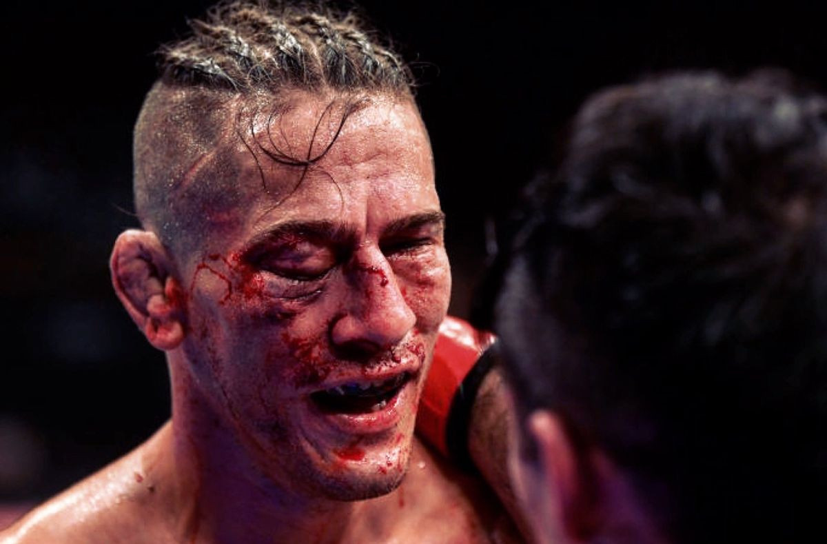 Pogledajte kako izgleda oko UFC borca nakon sinoćnjeg meča 