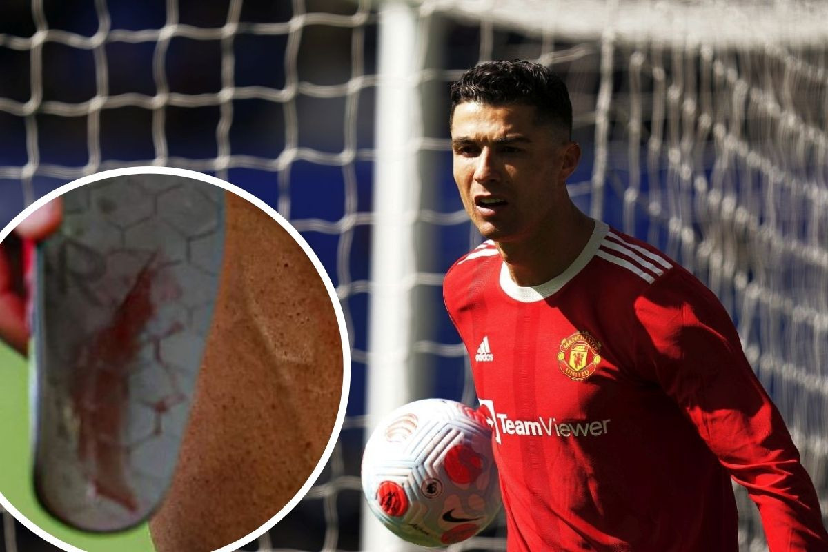 Mislili su da glumi povredu i bez razloga šepa, a onda je Ronaldo skinuo kostobran Mislili su da glumi povredu i bez razloga šepa, a onda je Ronaldo skinuo kostobran