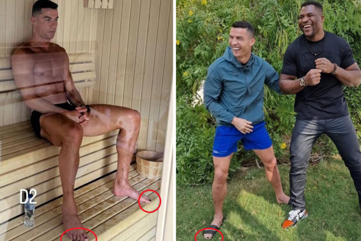 Cristiano Ronaldo lakira nokte, ali za to ima vrlo logično i razumno objašnjenje