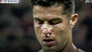 Ronaldu spao flaster s nosa, a onda se najbolje vidjelo kakav udarac je dobio