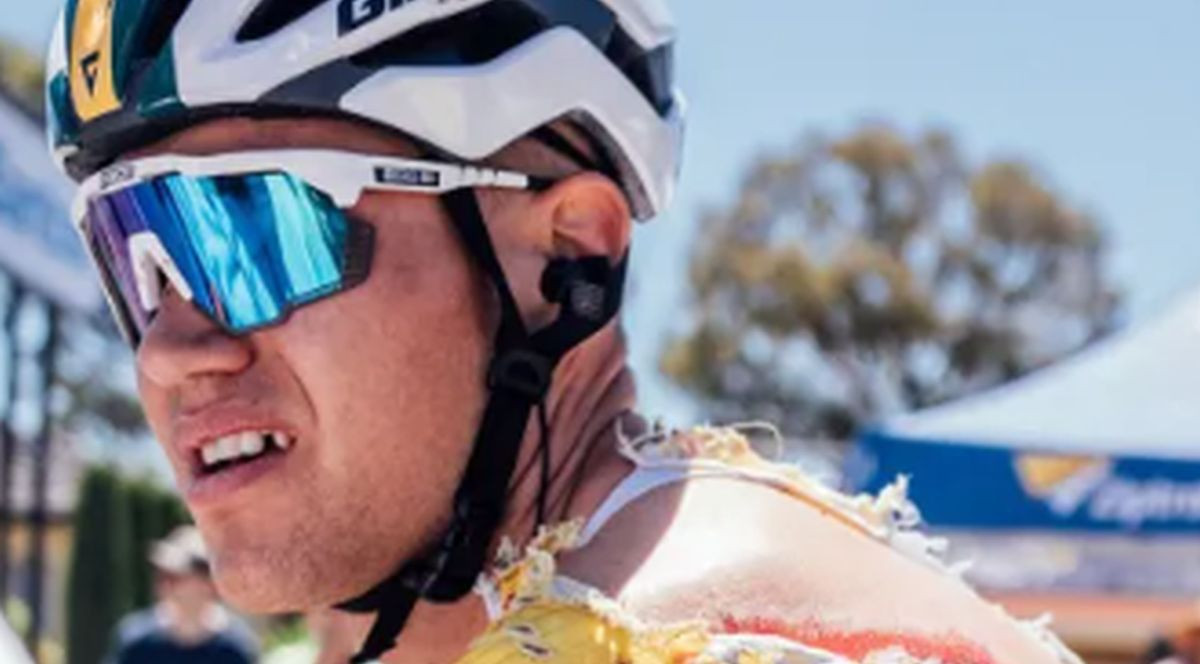 Uznemirujuće: Biciklist vozio prekriven krvlju i poderane kože na leđima