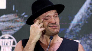 Tyson Fury tvrdi da je pokraden: "Usyk je bio prelagan meč, izgubio sam jer sam se za***avao"