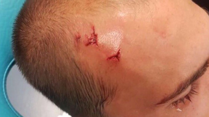 Incident kakav se ne pamti: Huligani upali u svlačionicu Sportinga i razbili glavu Basa Dosta!