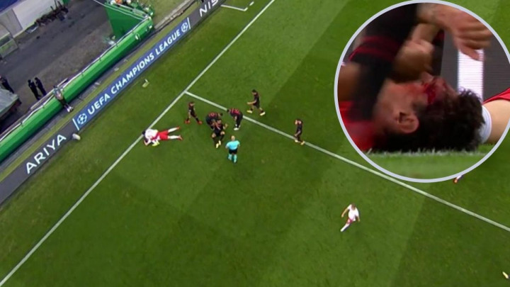 Žestok sudar na stadionu Jose Alvalade: Jeziv krik, krv, ali i olakšanje