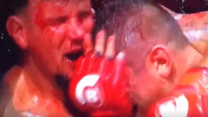 Krvavi sport: Brutalno prebijanje obilježilo noć na Havajima