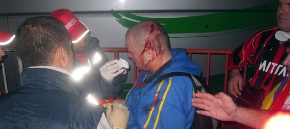 Policijska brutalnost u Portugalu