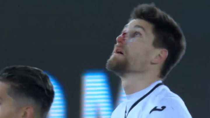 Kapitenu Swanseaja razbili nos dok je slavio gol protiv Liverpoola