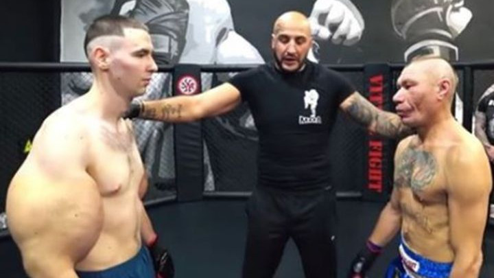 Ruski Popaj debitovao u MMA i izdržao samo tri minute, a uskoro bi mogao ostati bez ruku