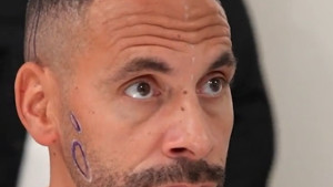 Nakon Hrvata, sada i Englez: Ferdinand se prepustio doktorima i za 4.000 dolara postao druga osoba!