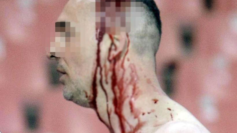 Uznemirujuće fotografije s beogradskog derbija