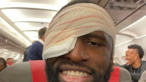 Rudiger pokazao kakav ožljak ima na čelu, ali su svi gledali u njegovo oko koje izgleda baš strašno