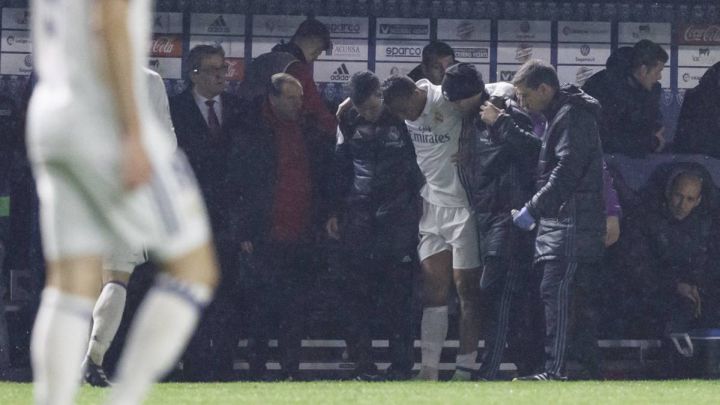 Užasno: Igrač Reala pokazao sliku noge nakon teškog starta