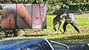 Nevjerovatna scena: Kengur pretukao bivšeg boksera i MMA trenera u nestvarnoj borbi