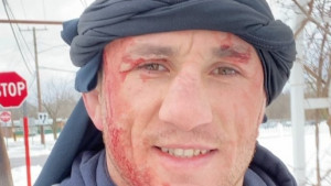 UFC borac mislio da je snijeg, pa glavom skočio na led: "Osjetio sam kako mi koža otpada"