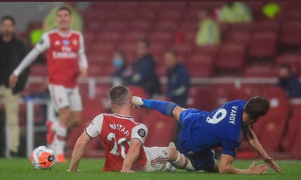 Štoper Arsenala Mustafi pokazao modrice nakon što ga je Vardy udario kopačkom u glavu 