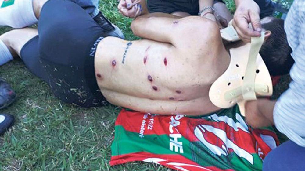 Policijska brutalnost nekad nema granicu: Izrešetan nogometaš