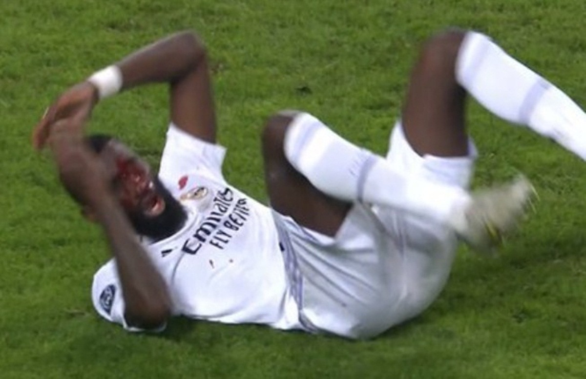 Junak Reala prilikom postizanja gola doživio stravičnu povredu