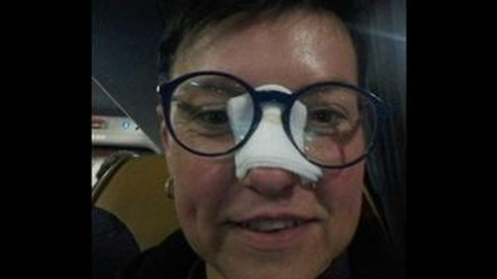 Eleni Ronaldo slomio nos, ona sada samo traži da je odvede na večeru