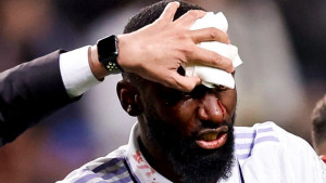 Navijači Real Madrida bruje o krvavom detalju na Rudigerovom dresu