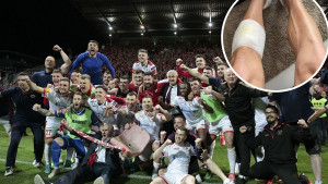 Fudbaler Veleža u svlačionici završio na šivanju: Stisnuo zube i finale odigrao krvave noge
