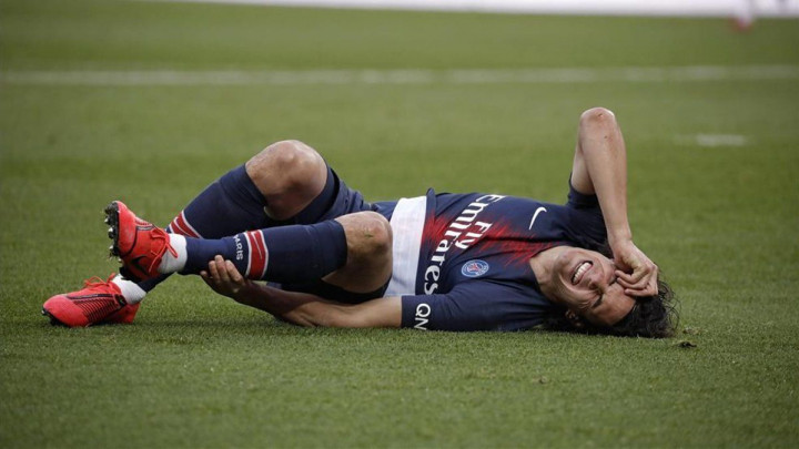 Edinson Cavani se povrijedio na bizaran način i neće igrati protiv Manchester Uniteda