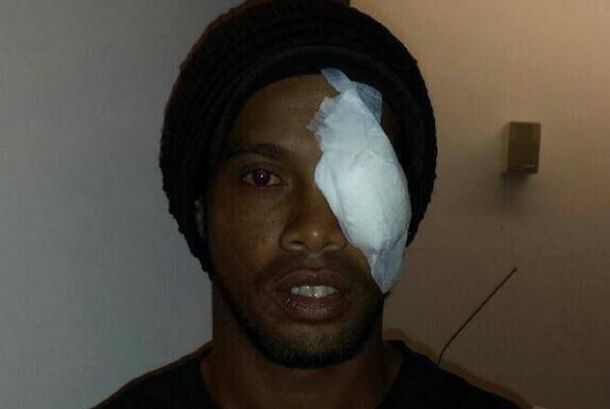 Ronaldinho povrijedio oko u meču sa Tijuanom Ronaldinho povrijedio oko u meču sa Tijuanom