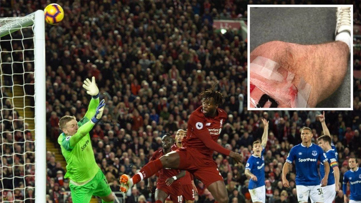 Navijač Liverpoola posvetio tetovažu "velikom" Divocku Origiju
