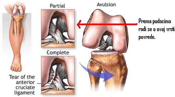ligamenti